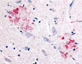 Antibody product image