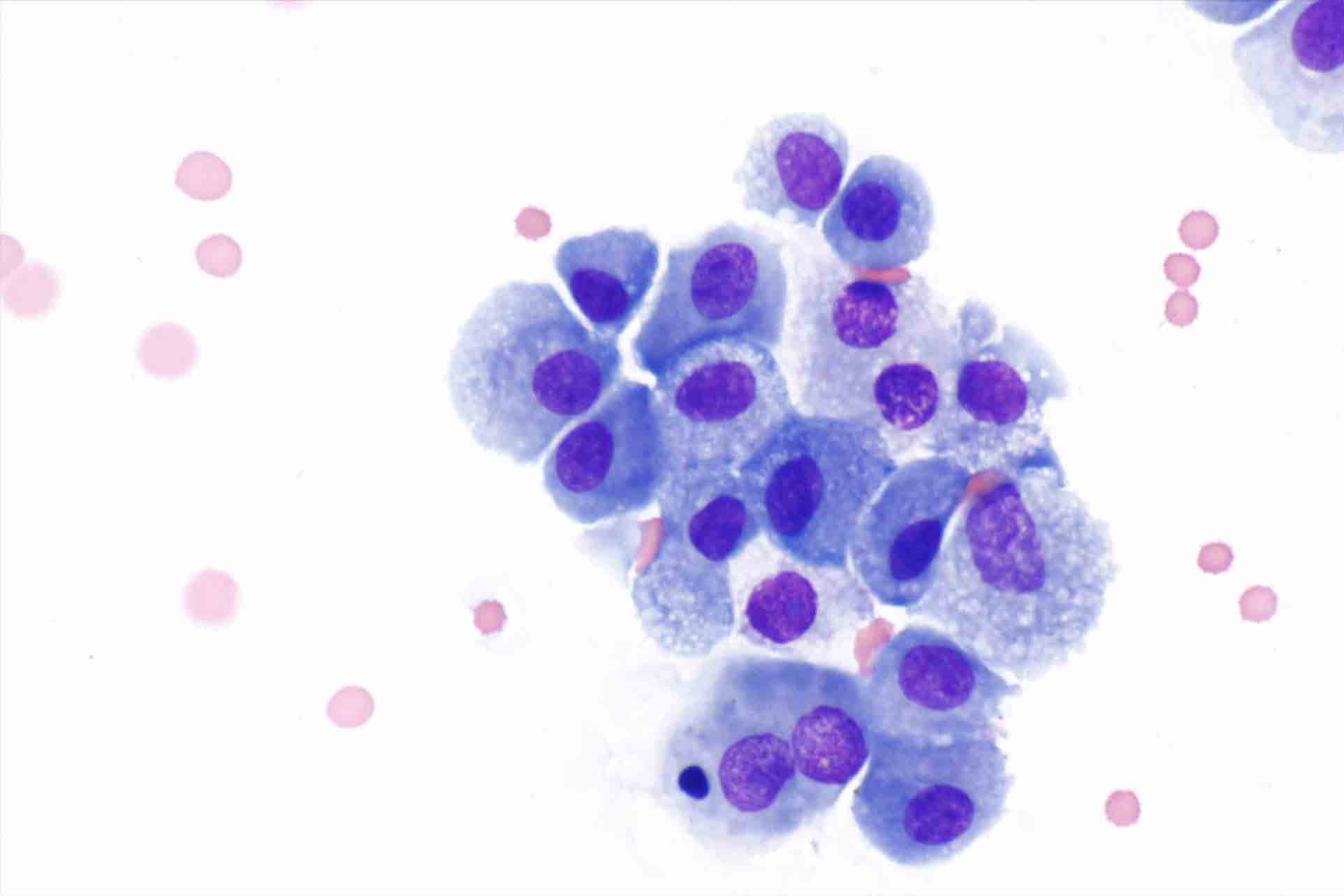 macrophages-wiki